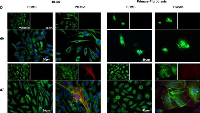 Rabbit IgG (H+L) Cross-Adsorbed Secondary Antibody in Immunocytochemistry (ICC/IF)