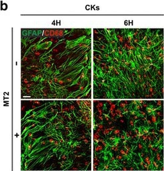 Mouse IgG (H+L) Cross-Adsorbed Secondary Antibody in Immunohistochemistry (Paraffin) (IHC (P))