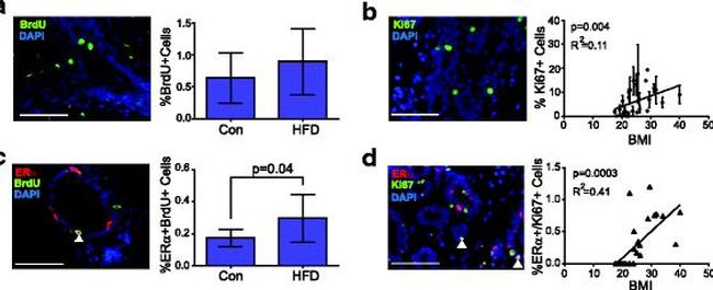 Rat IgG (H+L) Cross-Adsorbed Secondary Antibody in Immunocytochemistry (ICC/IF)