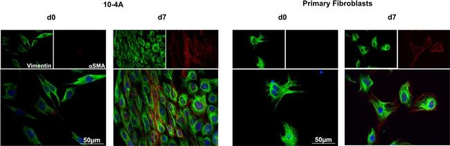 Rabbit IgG (H+L) Cross-Adsorbed Secondary Antibody in Immunocytochemistry (ICC/IF)