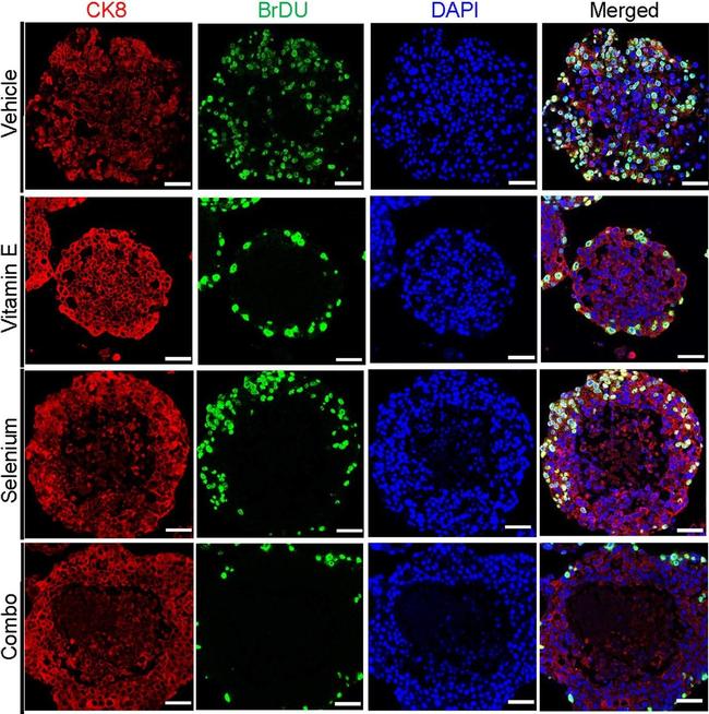 Rat IgG (H+L) Cross-Adsorbed Secondary Antibody in Immunocytochemistry (ICC/IF)