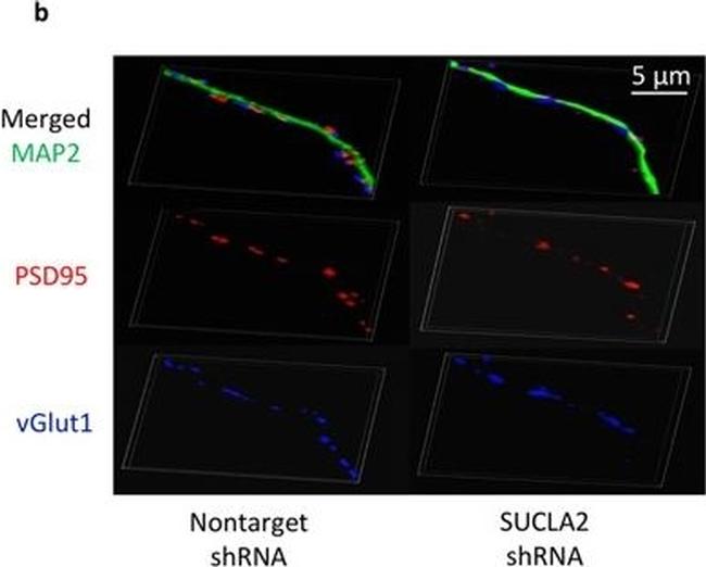 Mouse IgG (H+L) Highly Cross-Adsorbed Secondary Antibody in Immunocytochemistry (ICC/IF)