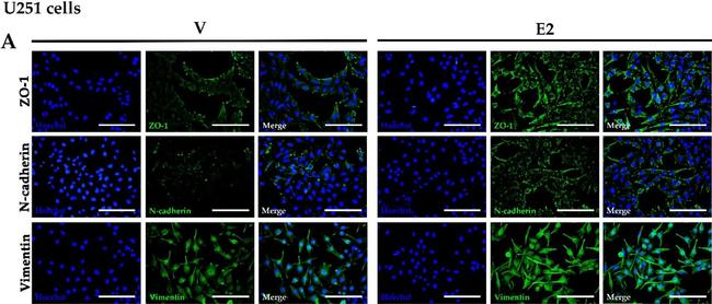 Mouse IgG (H+L) Cross-Adsorbed Secondary Antibody in Immunocytochemistry (ICC/IF)