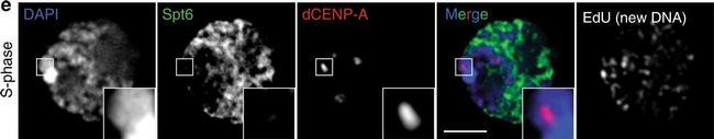 Mouse IgG (H+L) Cross-Adsorbed Secondary Antibody in Immunocytochemistry (ICC/IF)