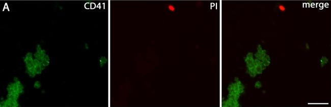 Rat IgG (H+L) Cross-Adsorbed Secondary Antibody in Immunocytochemistry (ICC/IF)