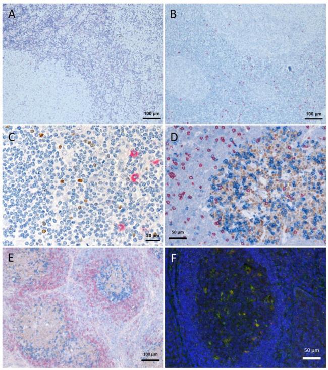 CD107a (LAMP-1) Antibody in Immunohistochemistry (IHC)