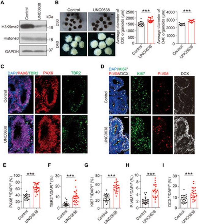 EOMES Antibody in Immunohistochemistry (IHC)