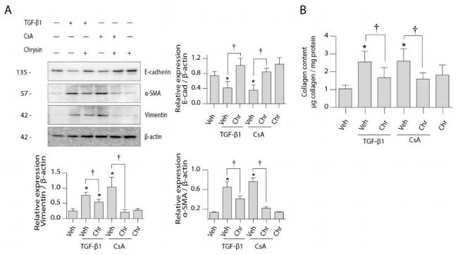 Alpha-Smooth Muscle Actin Antibody in Western Blot (WB)