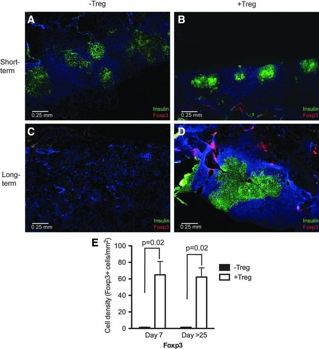 FOXP3 Antibody in Immunohistochemistry (IHC)