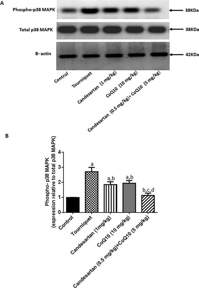 Phospho-p38 MAPK (Thr180, Tyr182) Antibody in Western Blot (WB)