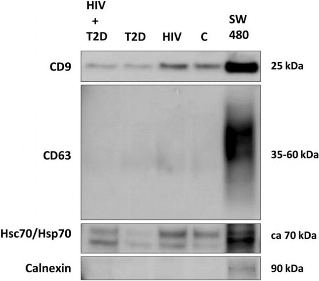 CD9 Antibody in Western Blot (WB)