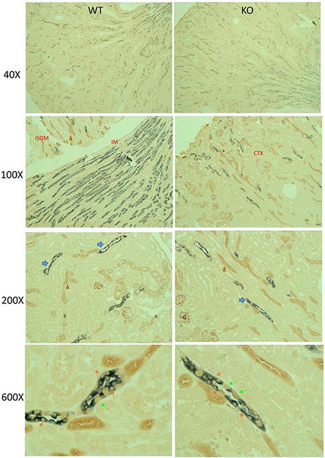 mTOR Antibody in Immunohistochemistry (IHC)