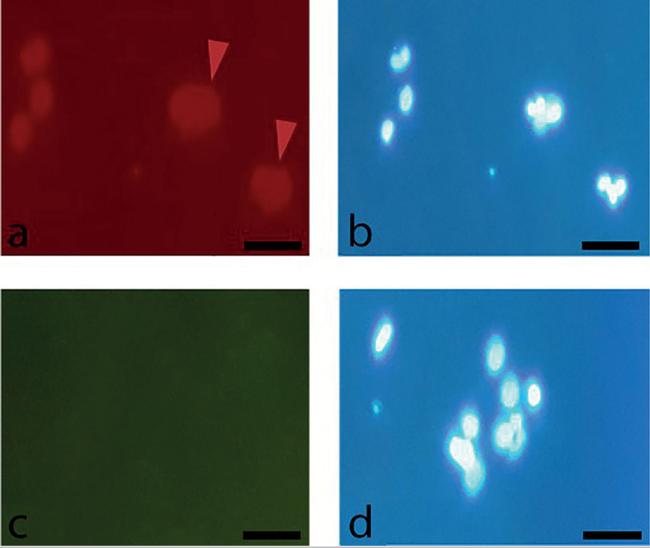 CD105 (Endoglin) Antibody in Immunocytochemistry (ICC/IF)