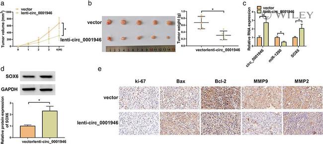 Bax Antibody in Immunohistochemistry (IHC)