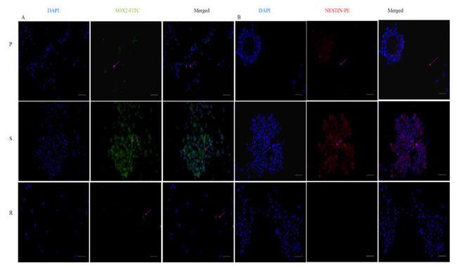 Nestin Antibody in Immunocytochemistry (ICC/IF)