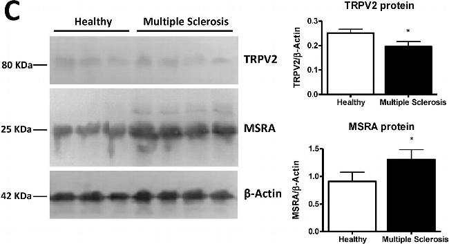 Rabbit IgG (H+L) Highly Cross-Adsorbed Secondary Antibody in Western Blot (WB)