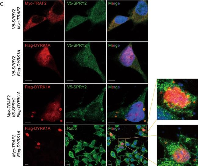 Rabbit IgG (H+L) Cross-Adsorbed Secondary Antibody in Immunocytochemistry (ICC/IF)