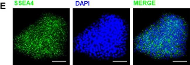 Mouse IgG (H+L) Cross-Adsorbed Secondary Antibody in Immunocytochemistry (ICC/IF)