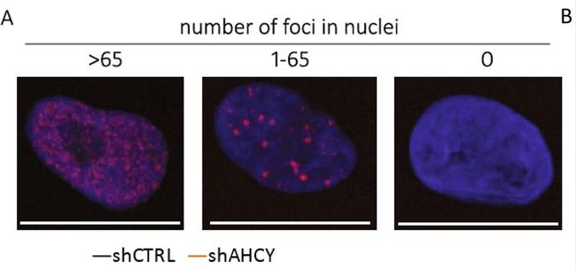 Mouse IgG (H+L) Cross-Adsorbed Secondary Antibody in Immunocytochemistry (ICC/IF)