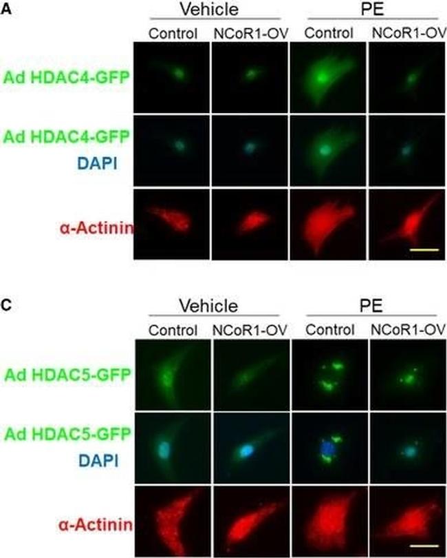 Mouse IgG (H+L) Cross-Adsorbed Secondary Antibody in Immunocytochemistry (ICC/IF)