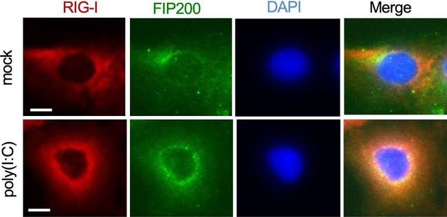 Rabbit IgG (H+L) Highly Cross-Adsorbed Secondary Antibody in Immunocytochemistry (ICC/IF)