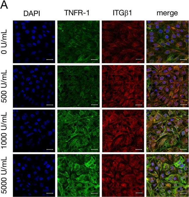 Mouse IgG (H+L) Cross-Adsorbed Secondary Antibody in Immunohistochemistry (IHC)