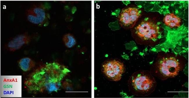 Rabbit IgG (H+L) Cross-Adsorbed Secondary Antibody in Immunocytochemistry (ICC/IF)