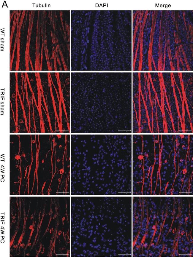 Rabbit IgG (H+L) Cross-Adsorbed Secondary Antibody in Immunohistochemistry (IHC)