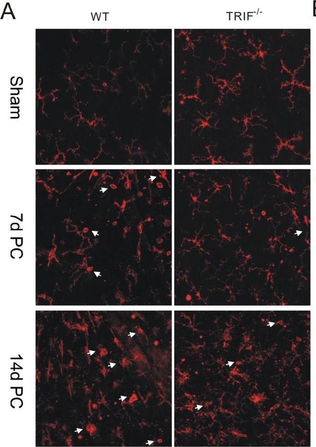 Rabbit IgG (H+L) Cross-Adsorbed Secondary Antibody in Immunohistochemistry (IHC)