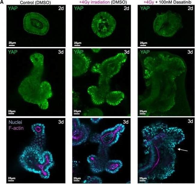 Rabbit IgG (H+L) Cross-Adsorbed Secondary Antibody in Immunohistochemistry (IHC)