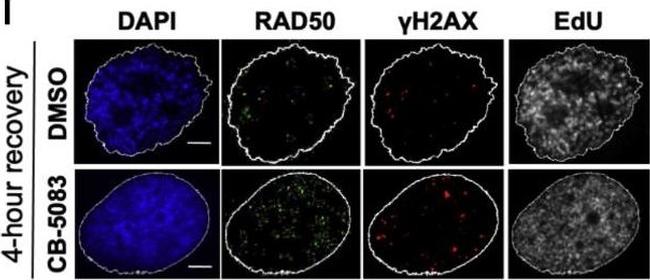 Rabbit IgG (H+L) Cross-Adsorbed Secondary Antibody in Immunocytochemistry (ICC/IF)