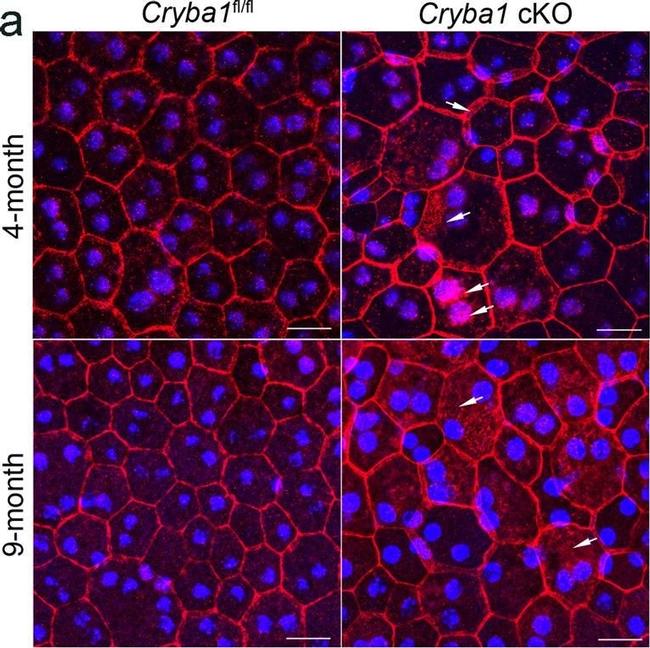 Rabbit IgG (H+L) Cross-Adsorbed Secondary Antibody in Immunohistochemistry (IHC)