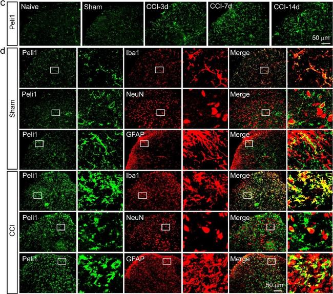 Rabbit IgG (H+L) Cross-Adsorbed Secondary Antibody in Immunohistochemistry (Frozen) (IHC (F))