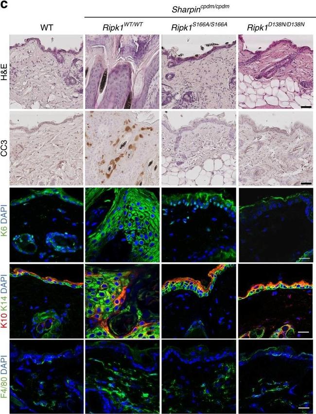 Rabbit IgG (H+L) Cross-Adsorbed Secondary Antibody in Immunohistochemistry (Paraffin) (IHC (P))