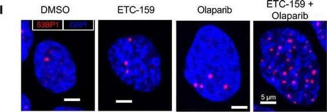 Rabbit IgG (H+L) Cross-Adsorbed Secondary Antibody in Immunocytochemistry (ICC/IF)