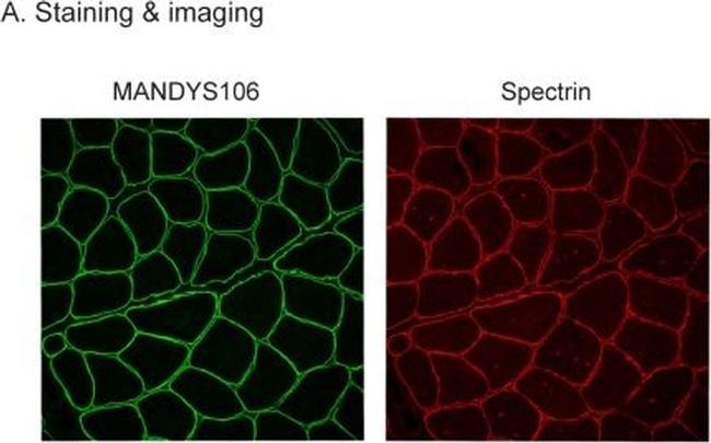 Mouse IgG (H+L) Highly Cross-Adsorbed Secondary Antibody in Immunohistochemistry (Frozen) (IHC (F))