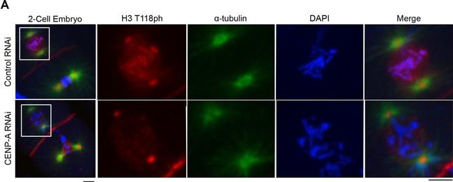 Mouse IgG (H+L) Highly Cross-Adsorbed Secondary Antibody in Immunocytochemistry (ICC/IF)