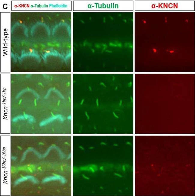 Mouse IgG (H+L) Highly Cross-Adsorbed Secondary Antibody in Immunohistochemistry (IHC)