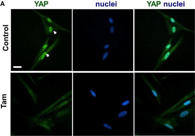 Mouse IgG (H+L) Highly Cross-Adsorbed Secondary Antibody in Immunocytochemistry (ICC/IF)