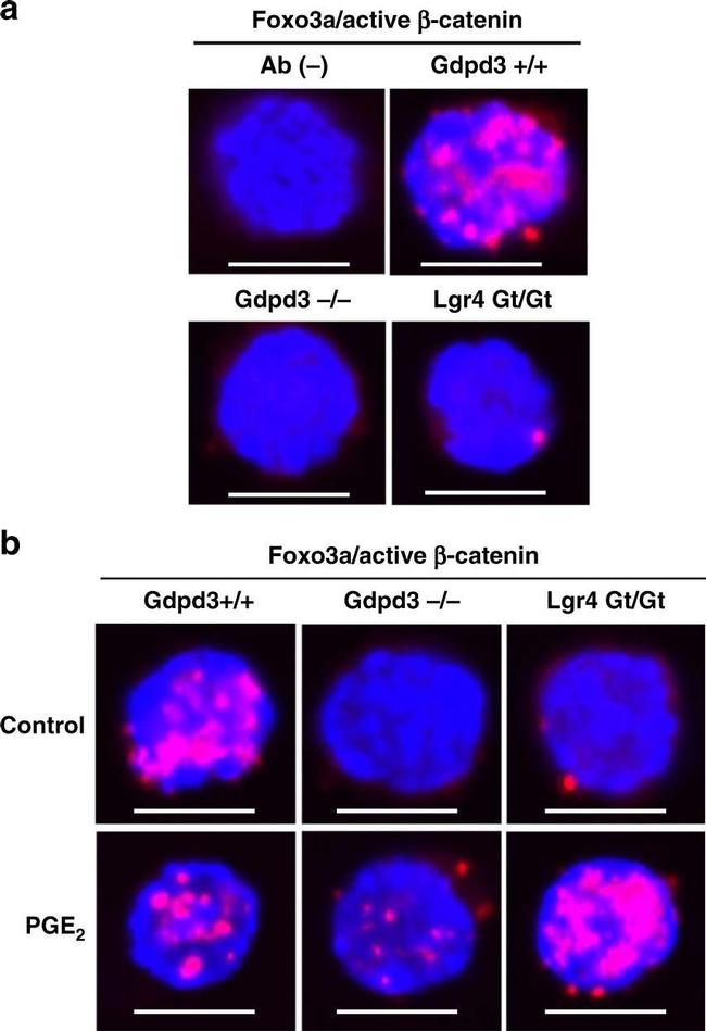 Mouse IgG (H+L) Highly Cross-Adsorbed Secondary Antibody in Immunocytochemistry (ICC/IF)