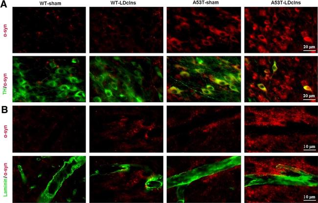 Mouse IgG (H+L) Highly Cross-Adsorbed Secondary Antibody in Immunohistochemistry (IHC)