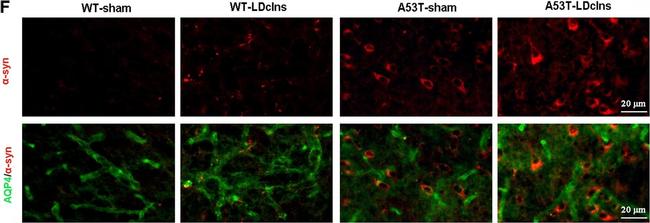 Mouse IgG (H+L) Highly Cross-Adsorbed Secondary Antibody in Immunohistochemistry (IHC)