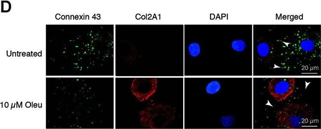 Mouse IgG (H+L) Highly Cross-Adsorbed Secondary Antibody in Immunocytochemistry (ICC/IF)