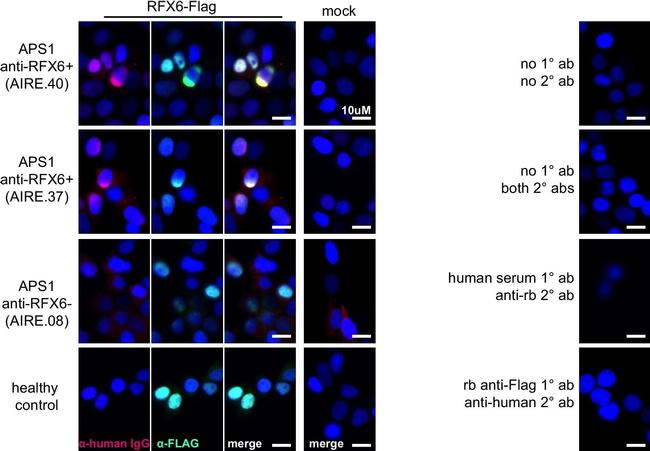 Rabbit IgG (H+L) Highly Cross-Adsorbed Secondary Antibody in Immunocytochemistry (ICC/IF)