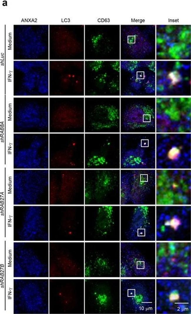 Rabbit IgG (H+L) Highly Cross-Adsorbed Secondary Antibody in Immunocytochemistry (ICC/IF)