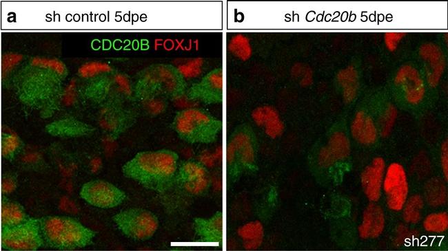 Mouse IgG1 Cross-Adsorbed Secondary Antibody in Immunocytochemistry (ICC/IF)