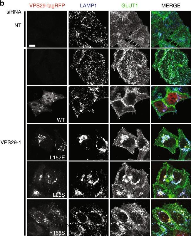 Rabbit IgG (H+L) Highly Cross-Adsorbed Secondary Antibody in Immunocytochemistry (ICC/IF)