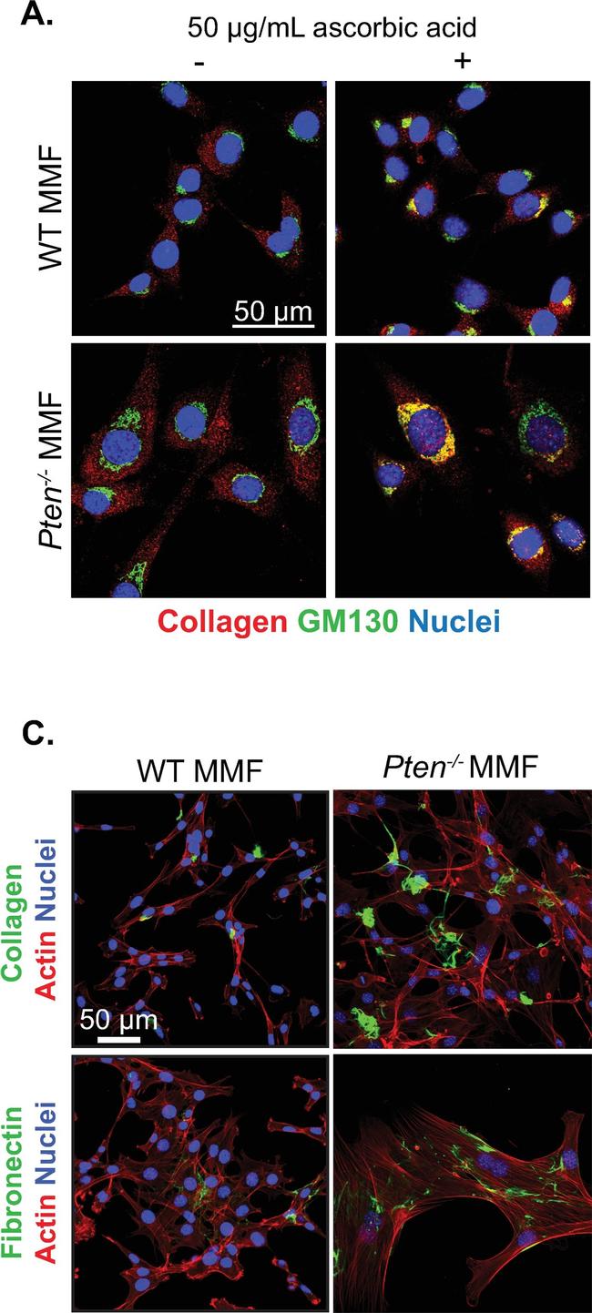 Rabbit IgG (H+L) Highly Cross-Adsorbed Secondary Antibody in Immunocytochemistry (ICC/IF)