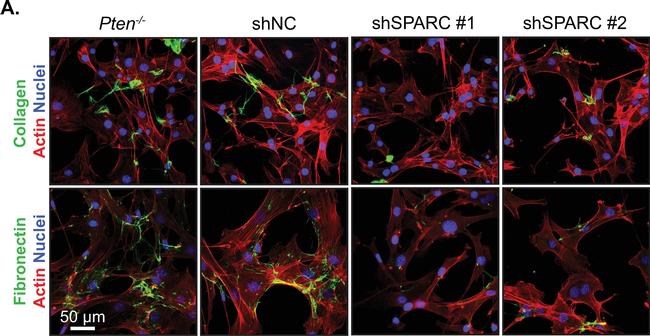 Rabbit IgG (H+L) Highly Cross-Adsorbed Secondary Antibody in Immunocytochemistry (ICC/IF)