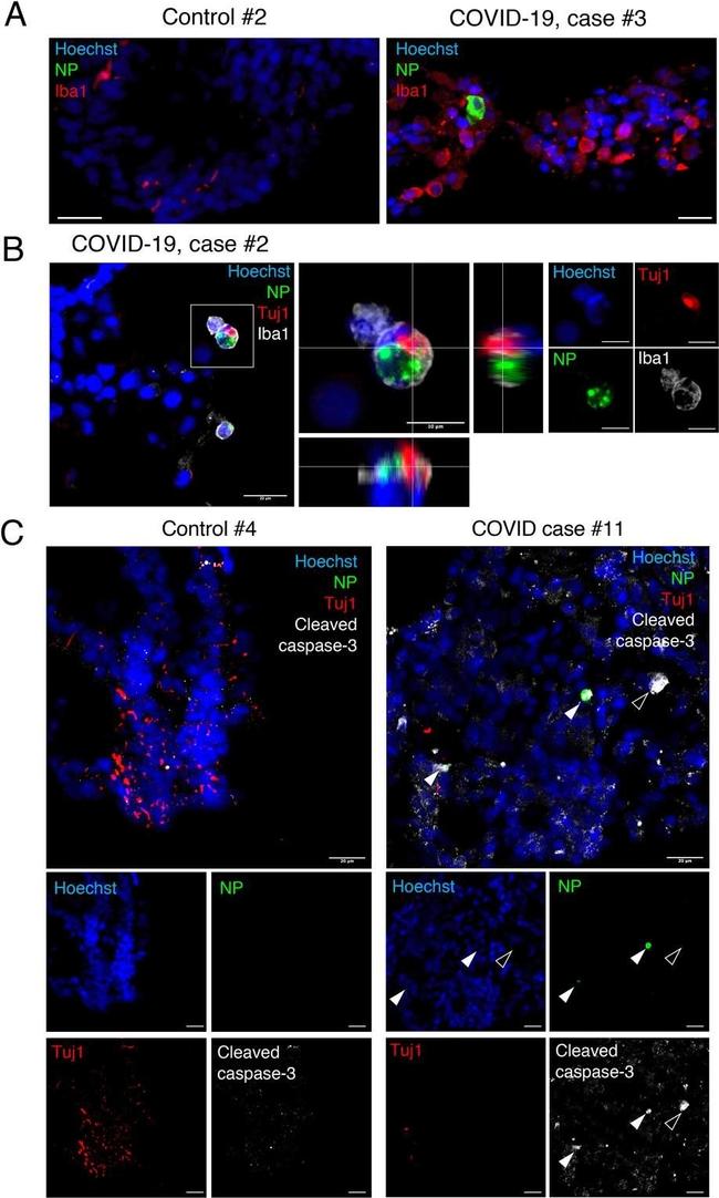 Rabbit IgG (H+L) Highly Cross-Adsorbed Secondary Antibody in Immunocytochemistry (ICC/IF)